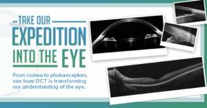 OCT in Ophthalmology