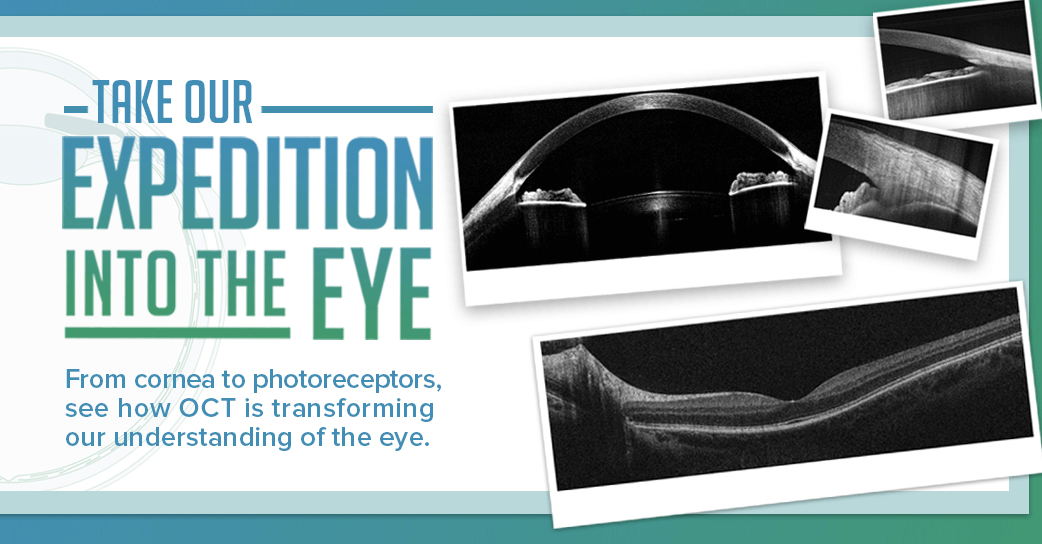 OCT in Ophthalmology