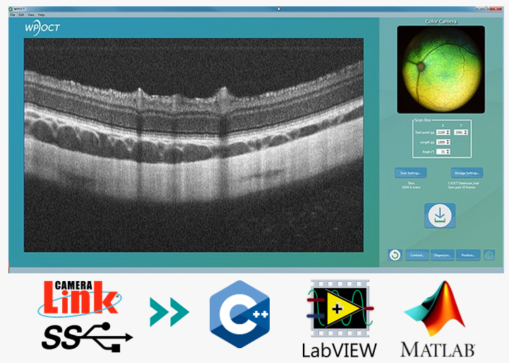 Image of screenshot from Wasatch Photonics OCT Software suite.