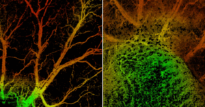 Wasatch Photonics The OCT Landscape Expands