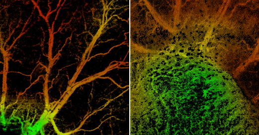 Wasatch Photonics The OCT Landscape Expands