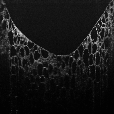 Image of Wasatch Photonics OCT pumpkin fibers.